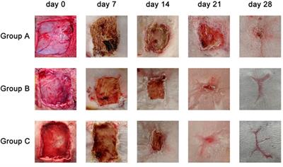 A novel wound dressing material for full-thickness skin defects composed of a crosslinked acellular swim bladder